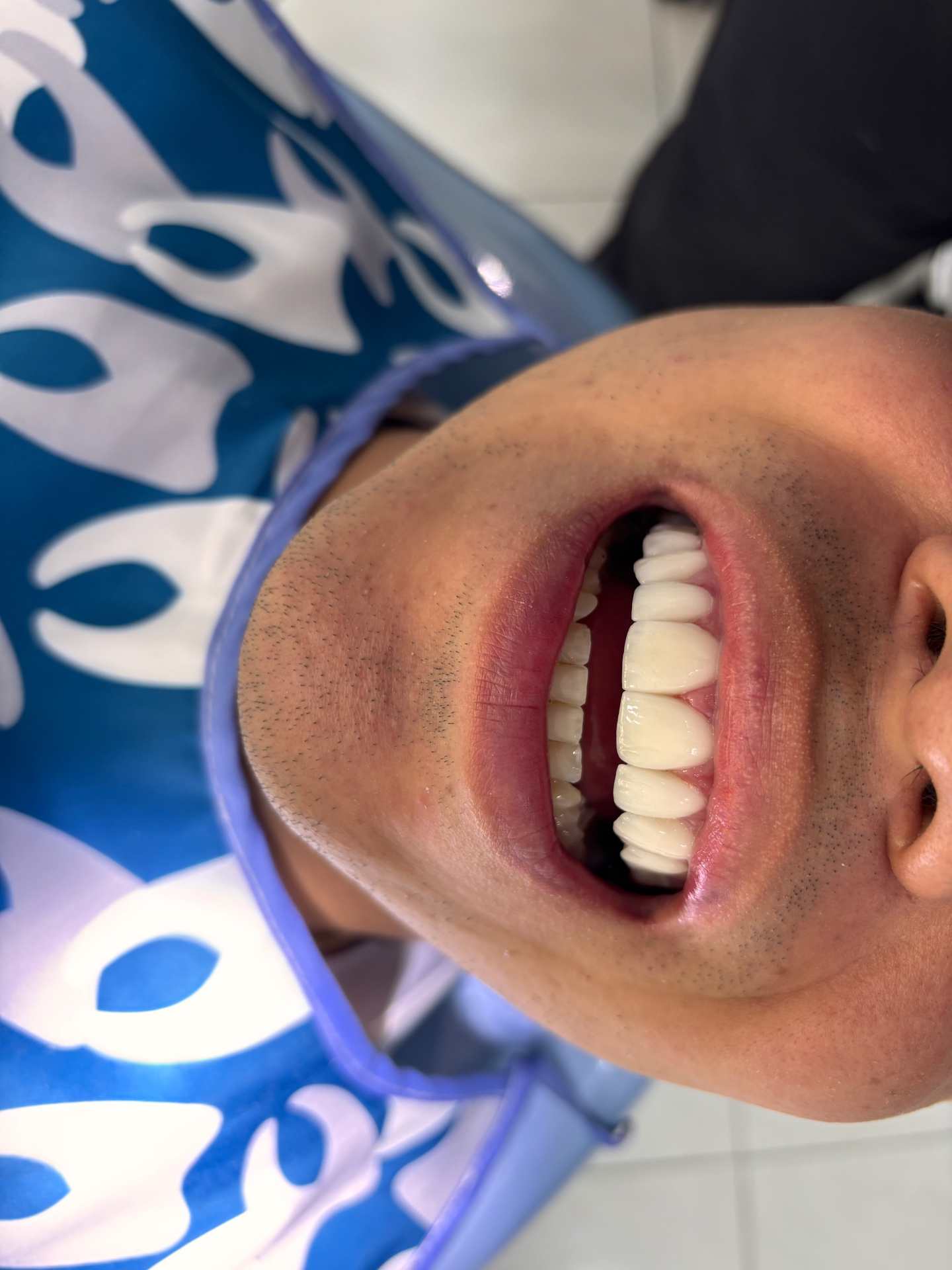 Resultado de estética dental